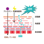 水分が不足している肌　Skin where moisture is insufficient